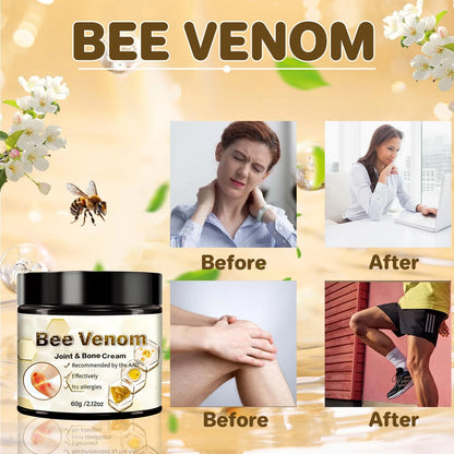 ✨¡BYE BYE IMPERFECCIONES CON BEE VENOM CREAM!🐝